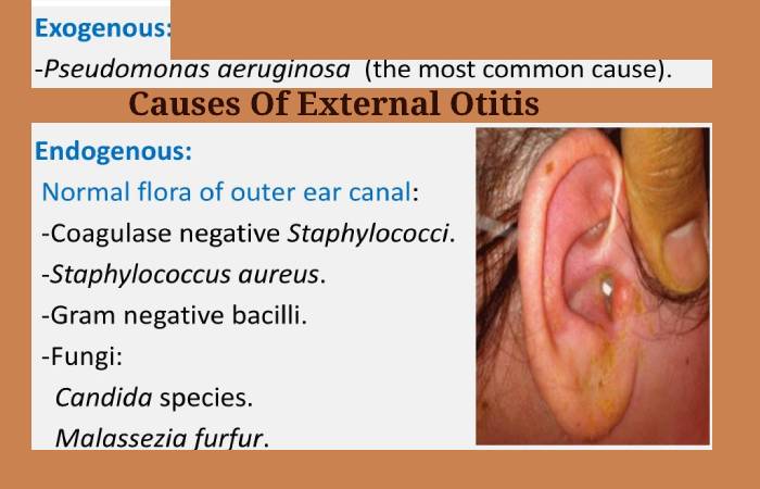 Causes Of External Otitis
