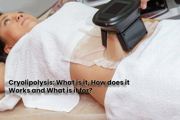 Cryolipolysis: What is it, How Does it Works and What is it for?