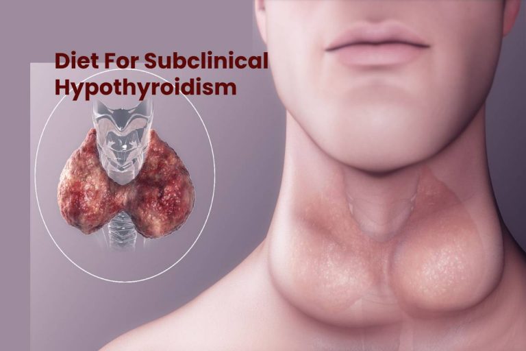 Diet For Subclinical Hypothyroidism