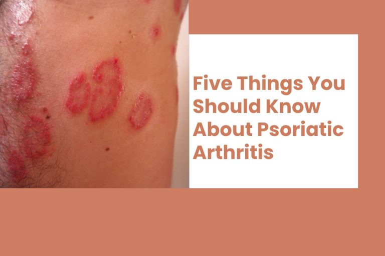 Five Things You Should Know About Psoriatic Arthritis