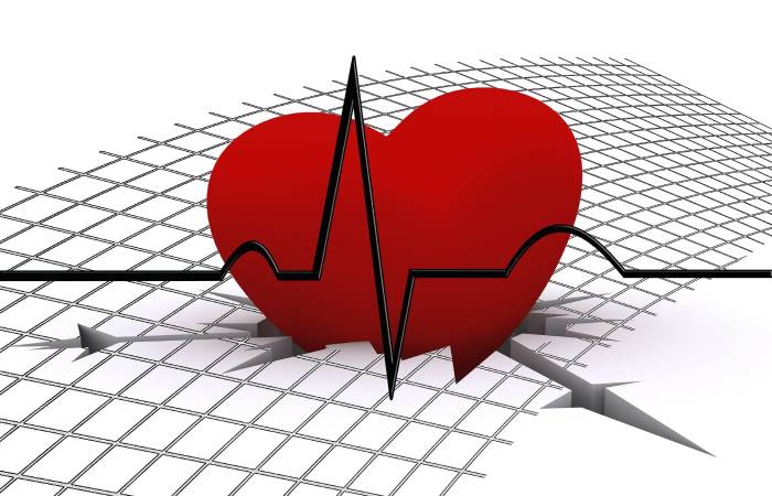 What Didn't You Know About Cardiac Arrhythmia? - Health4Fitness