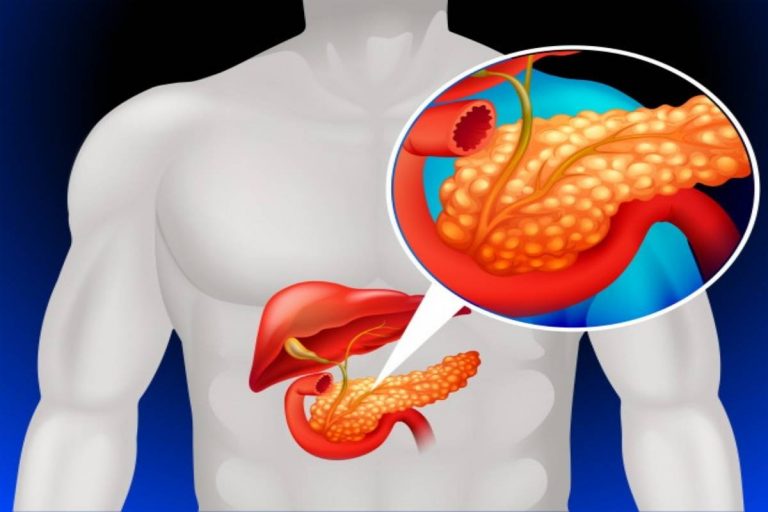 Pancrease: Functions, Location & Disorders and More