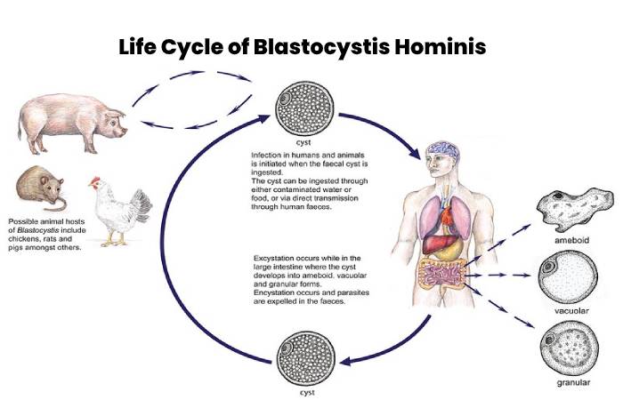 Blastocystis Hominis 
