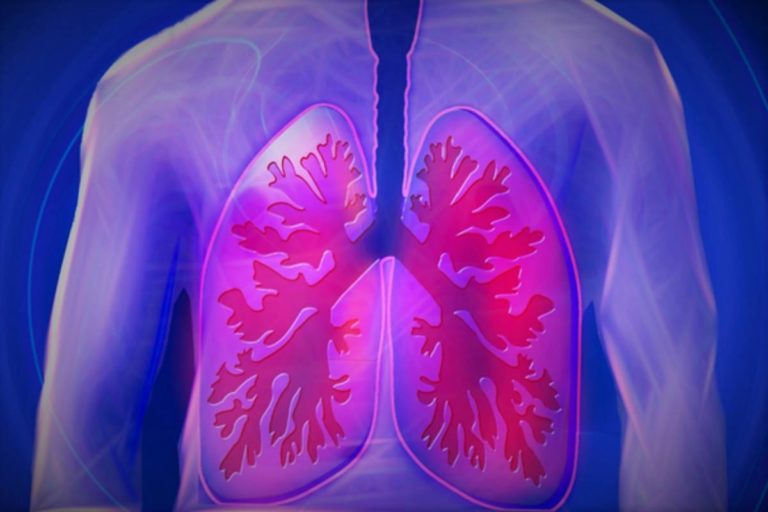 Common Lung Diseases And Tips To Alleviate Breathing Pain