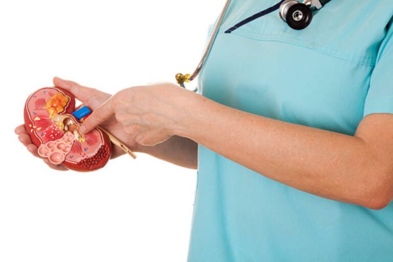 Do I Need Surgery For Kidney Stones?