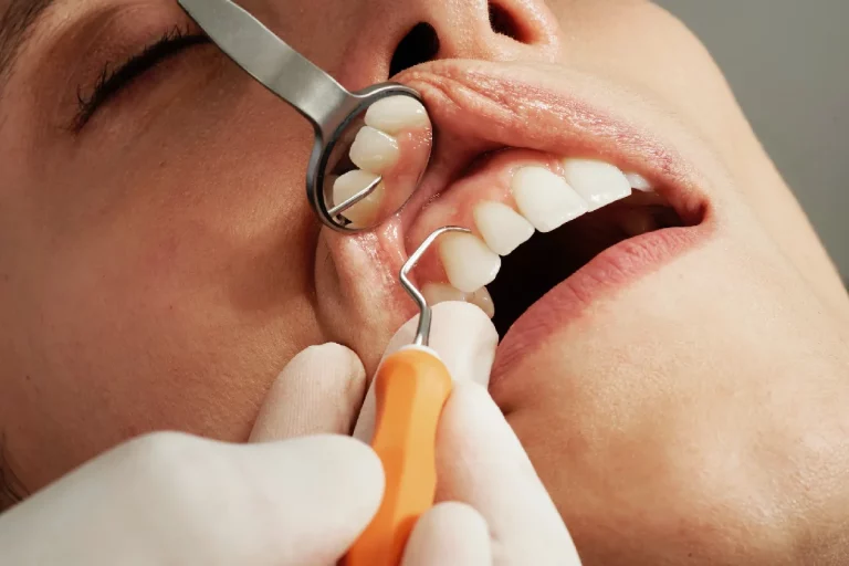 Confused About Teeth Implant Treatment? Six Myths Debunked