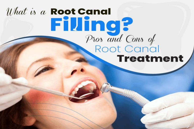 Root Canal Filling Pros And Cons And  Canal Treatment