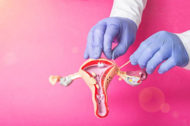 Tubal Ligation Reversal: The Complete Guide