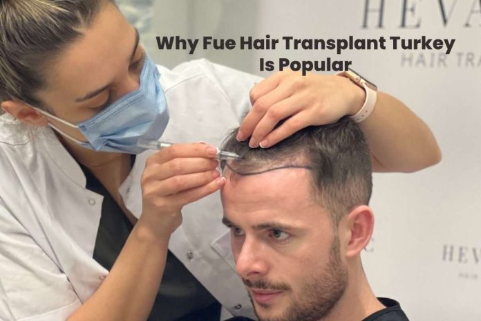 FUE hair transplant