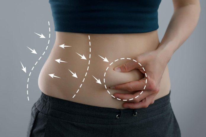 Tummy Tuck Surgery